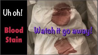 HOW TO REMOVE BLOOD FROM FABRIC | BLOOD STAIN IN COMFORTER | HYDROGEN PEROXIDE