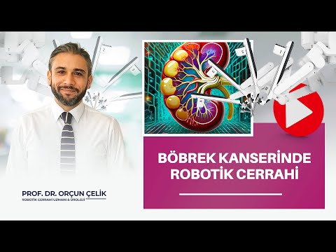 Importance of Robotic Surgery in Kidney Cancer