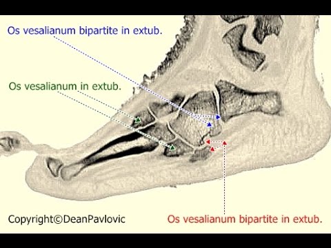 Ginnastica per le articolazioni crisi Trattamento delle articolazioni zucchine
