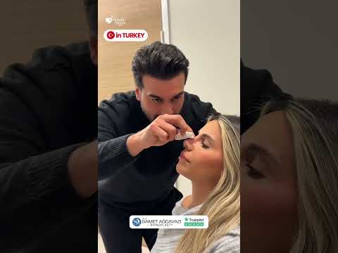 Nose Job in Istanbul | Beautiful Rhinoplasty Before & After by Op. Dr. Samet Ağcayazı
