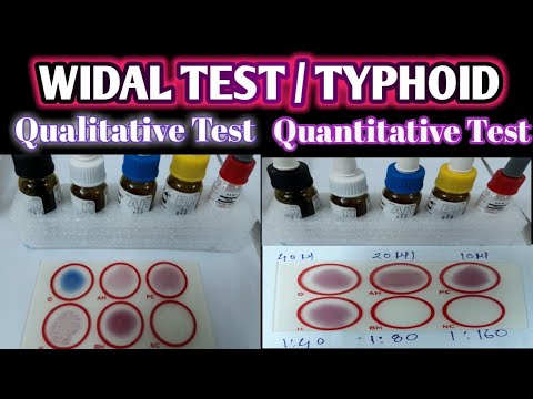 Wdial Test Hi Per Kit.pdf Typhoid Test Kit - Typhoid Diagnostic Kits Latest Price, Manufacturers ...