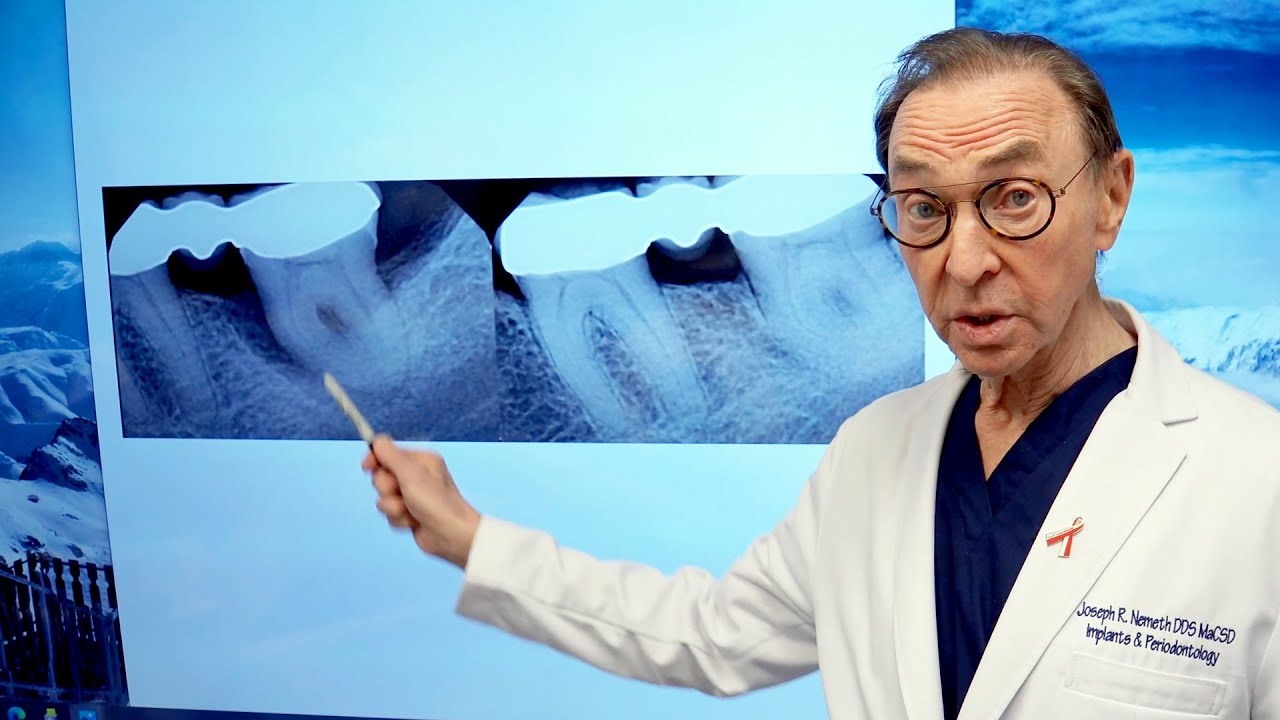 How To GROW BONE Lost To Gum Disease - AMAZING Results!