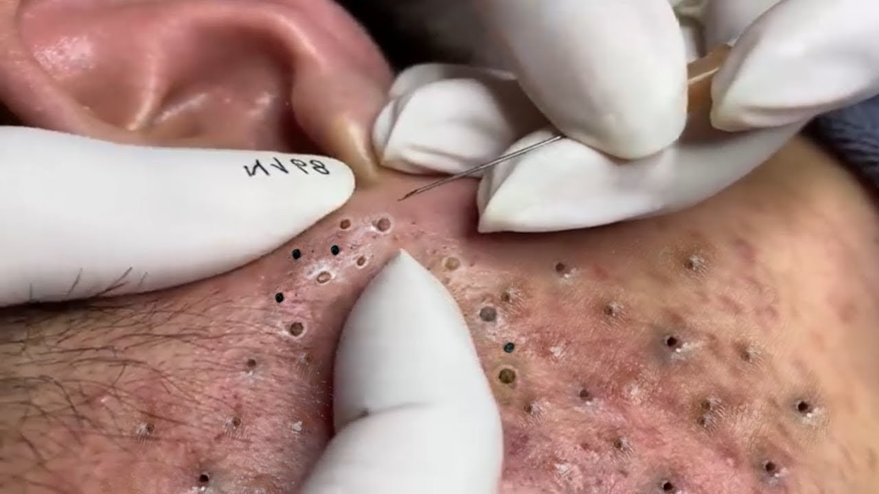 𝑺𝒐𝒐𝒕𝒉𝒊𝒏𝒈 𝑭𝒂𝒄𝒊𝒂𝒍 𝑻𝒓𝒆𝒂𝒕𝒎𝒆𝒏𝒕 𝑭𝒐𝒓 𝑺𝒕𝒓𝒆𝒔𝒔 𝑹𝒆𝒍𝒊𝒆𝒇 𝒂𝒕 𝑳𝒖𝒙𝒖𝒓𝒚 𝑺𝒑𝒂 𝑨𝒄𝒉𝒊𝒆𝒗𝒆 𝑰𝒏𝒏𝒆𝒓 𝑷𝒆𝒂𝒄𝒆 #500349