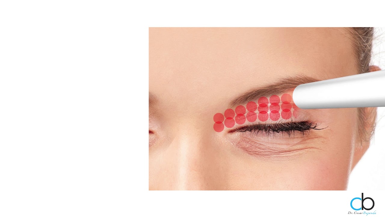 César Noé Bujanda Mena-19