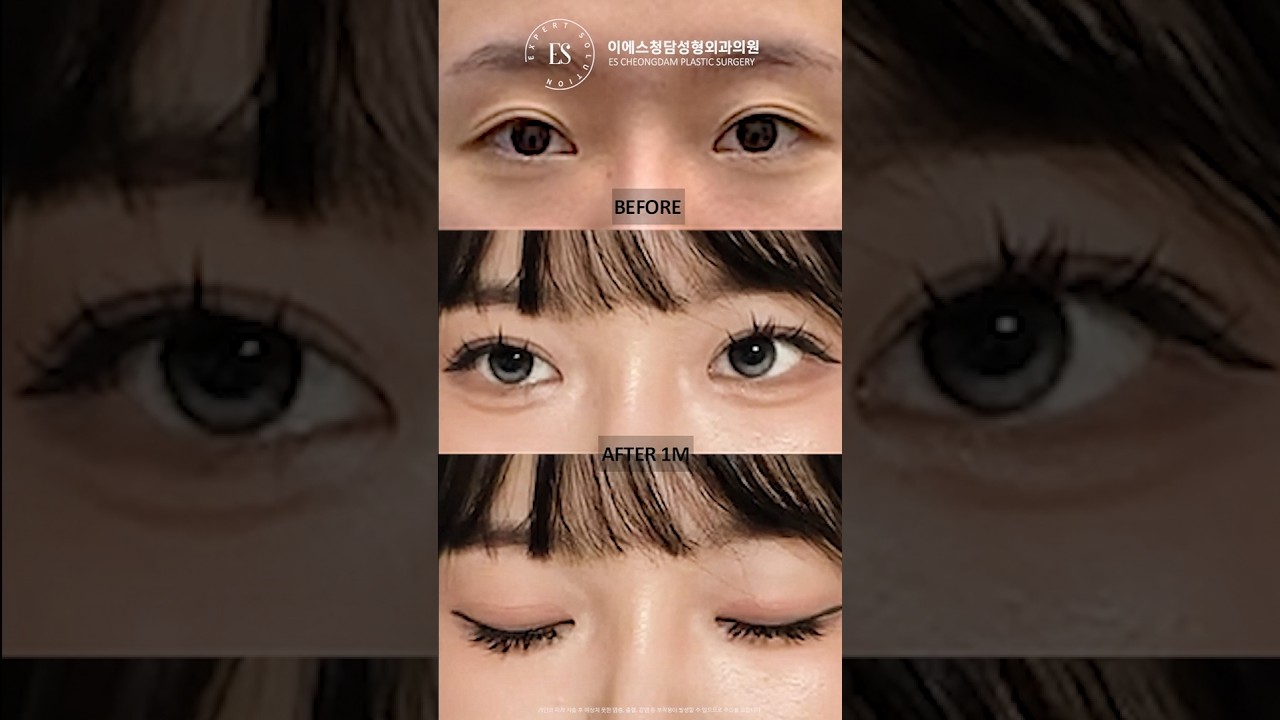 이에스 유튜브