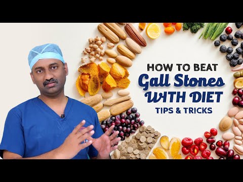 Best Diet tips for Gallstones! | Dr Parthasarathy #Gallstonestips