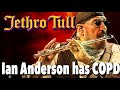 Jethro Tull's Ian Anderson Reveals He Has COPD