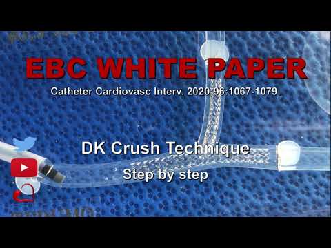 Técnicas en Bifurcaciones: DK Crush In Vitro