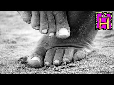 Cosa cè di sbagliato con giunti cliccando Da ciò distrutta dellanca in un bambino