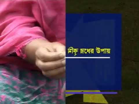 ছাগলের রোগবালাই দমন