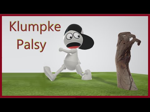 Klumpke Palsy (Mnemonic for the USMLE)