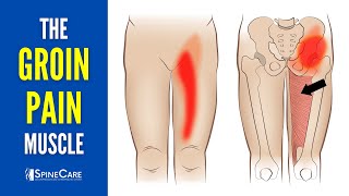 The Groin Pain Muscle (How to Release It for INSTANT RELIEF)