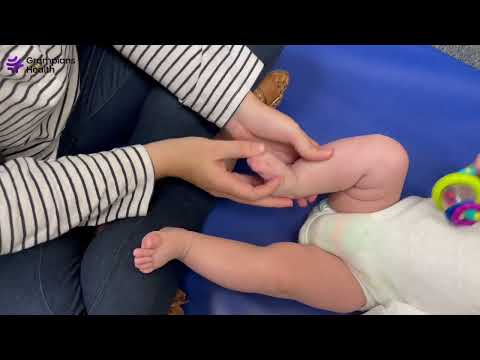 Physio   Positional Talipes Equinovarus