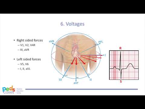 Approach to Pediatric ECGs (Part 2/2)