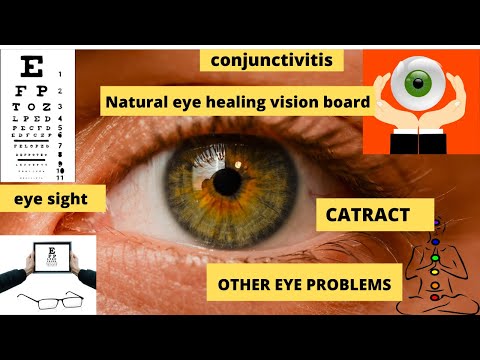 Naturally heal eyesight,cataract,glucoma and other eye problems||powerful eye mantra +vision board