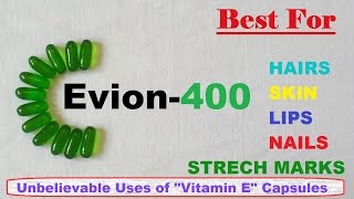 Evion  400 : Unbelievable  Uses of "Vitamin E" Capsules