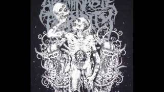 Abominable Putridity (blindfold surgery)