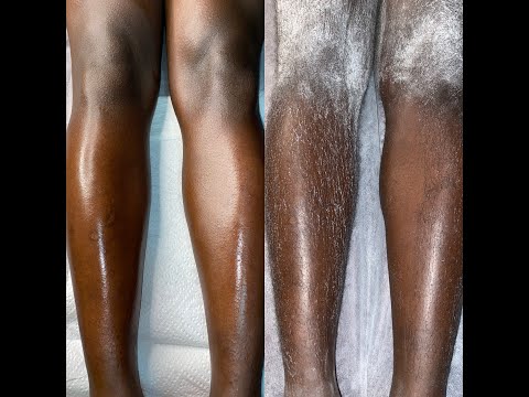 Full Leg Sugaring | Professional Sugar Waxing