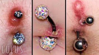 DO NOT Let This Happen To Your Piercing! **GROSS**