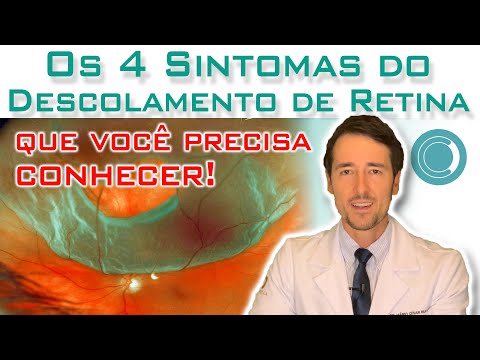 Symptoms of Retinal Detachment