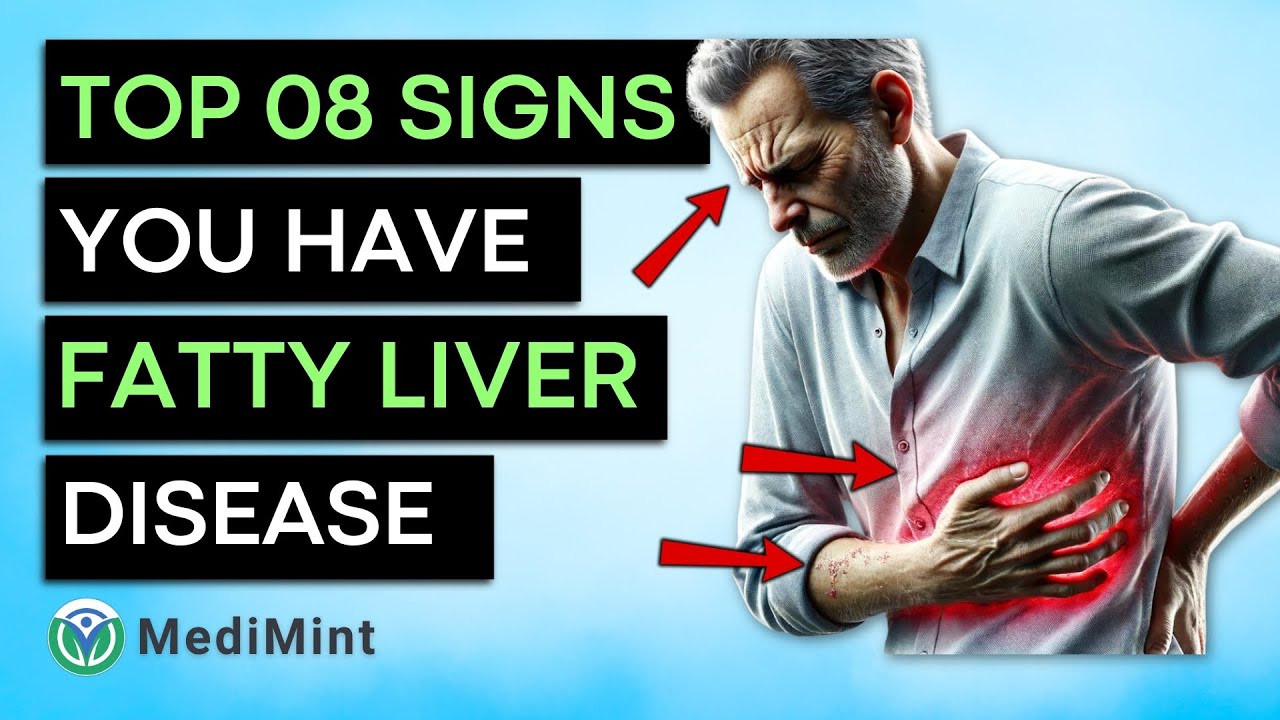 Top 8 Early Signs You Have Fatty Liver Disease
