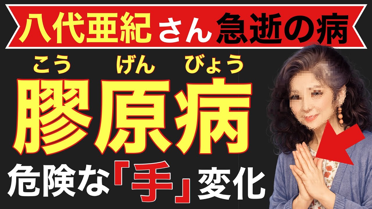 【八代亜紀さん急逝】危険な膠原病の「手」に出るサインとは？知らないと後悔する。