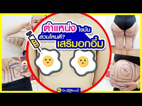หน้าอกเล็กกับตัวเลขขนาดใหญ่ อาจจะเป็นเต้านมหลัง mammoplasty