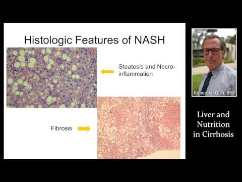 LIVER & NUTRITION IN CIRRHOSIS by Dr. Robert Gish