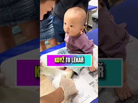 Miminku sundali sádru! 👶🦴😲