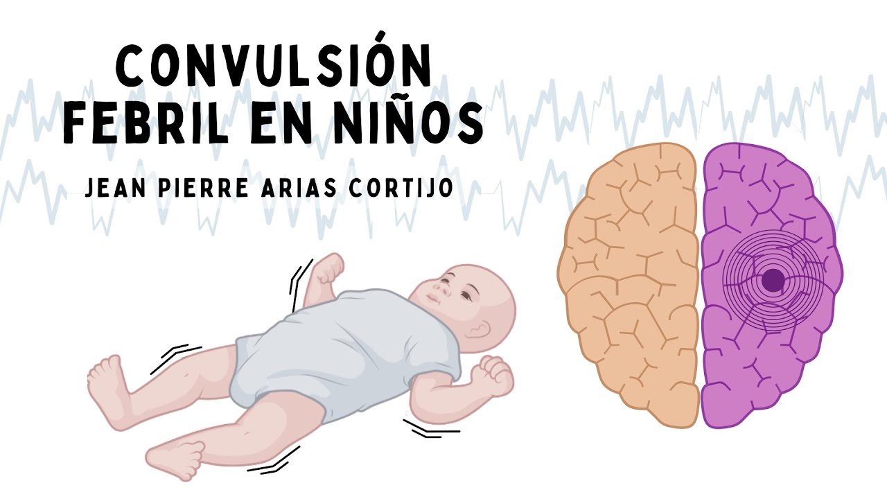 Convulsión febril en niños: etiología, fisiopatología, diagnóstico y tratamiento