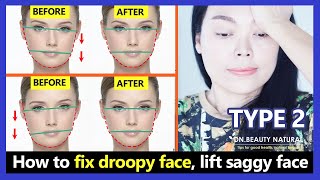 (Type 2) How to fix droopy face, lift saggy face, face exercises for sagging face and uneven faces.