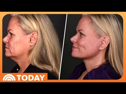 醫美診所的客群越來越年輕、男性也越來越多了！ (Cosmetic Surgery is Drawing Younger Patients and More Men)