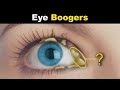 What Are Eye Boogers? | Eye Discharge (Rheum) In Eyes