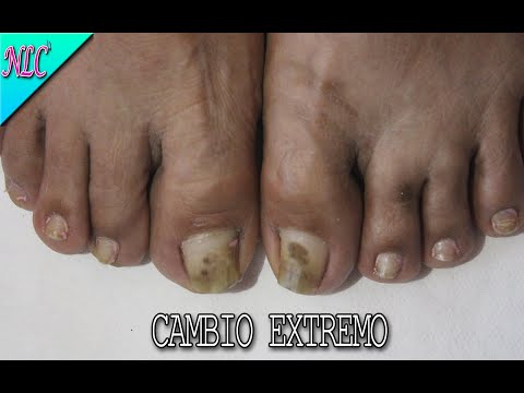 COMO HACER UN PEDICURE PASO A PASO PRINCIPIANTES ¡BIEN EXPLICADO CON VOZ! – HOW TO PEDICURE – NLC