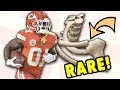 Tyreek Hill Hospitalized With RARE Shoulder Injury Doctor Explains SC Dislocation