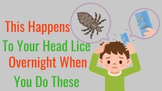 How to Get Rid of Head Lice  And Eggs