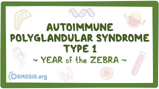 Autoimmune polyglandular syndrome type I - NORD (Year of the Zebra)