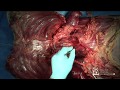 Thoracic Cavity Overview