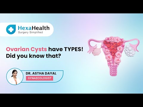 Types of Ovarian Cysts|| HexaHealth Expert