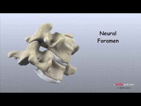 Tratamentul artrozei de gradul I al articulației genunchiului