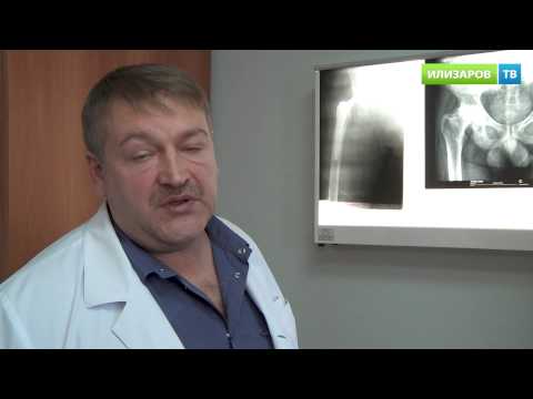 Наколенник для фиксации коленного сустава где купить Остеохондроз 1-2 стадии поясничного отдела