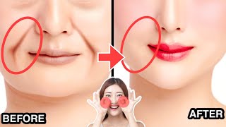 9MINS LAUGH LINES REMOVAL EXERCISE (Nasolabial Folds) | Lift Jowls, Sagging Cheeks