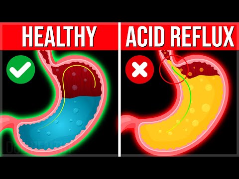 11 POWERFUL Reasons You Need To Use Apple Cider Vinegar DAILY Apple Cider Vinegar Benefits