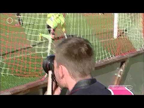 NBI Premier DVTK-PAFC