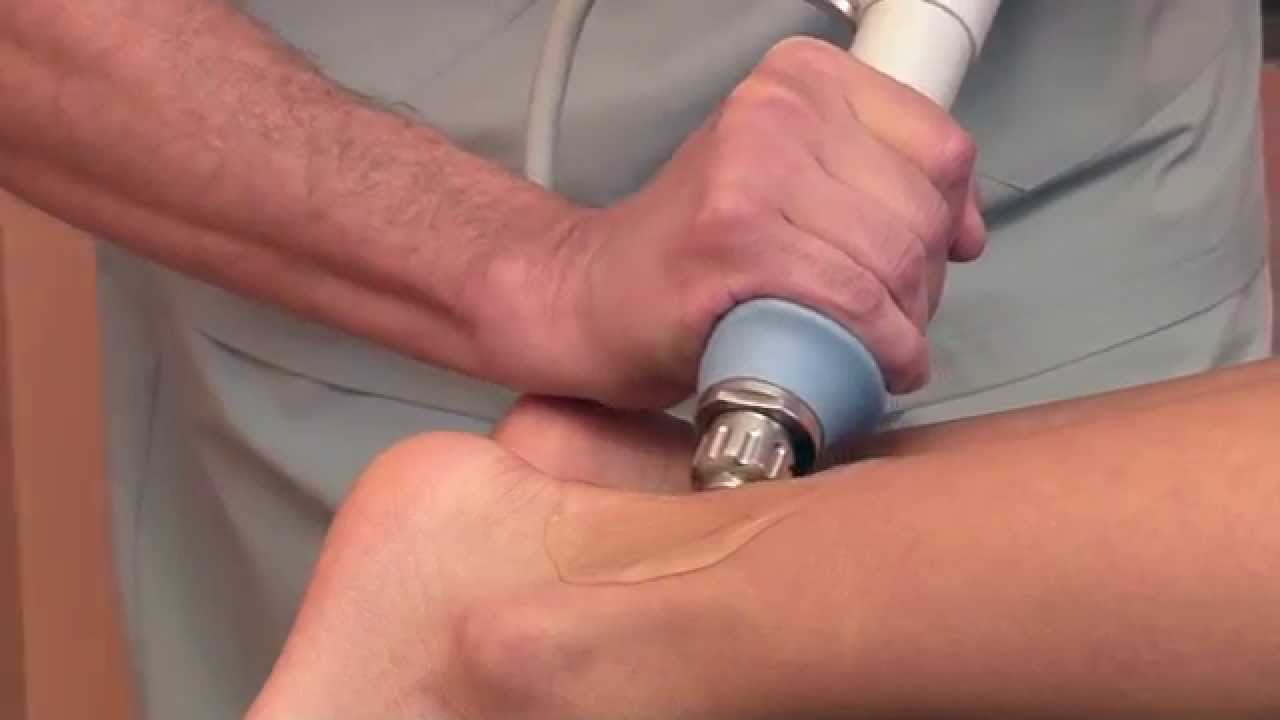 Terapia por Ondas de Choque con Lic. Enrique Barroca