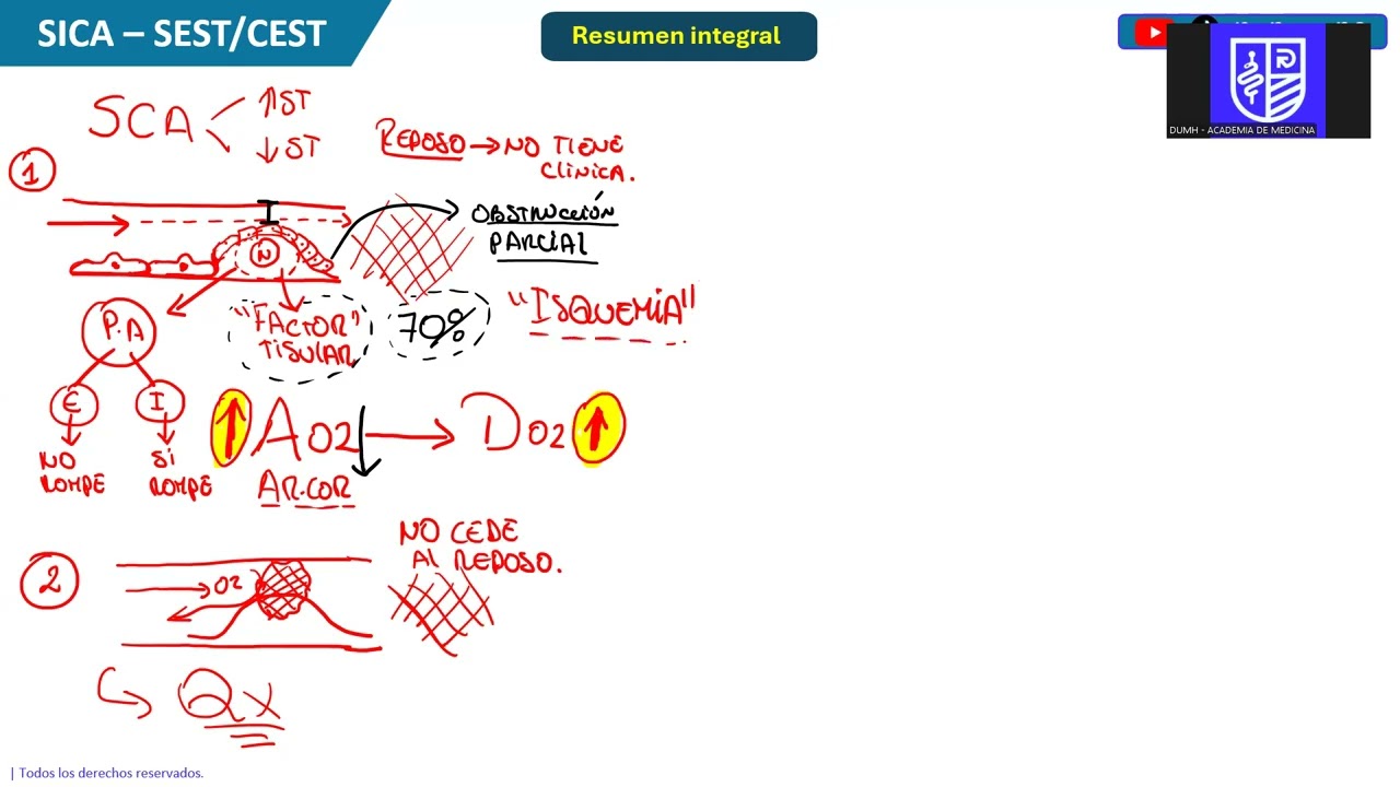 SINDROME CORONARIO AGUDO - SEST/CEST
