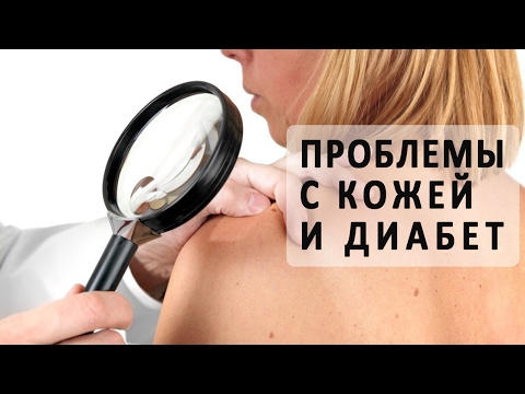 Удаление глубоких пигментных пятен Избавиться от пигментных пятен за месяц