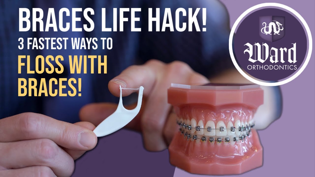 Ward Orthodontics featured video