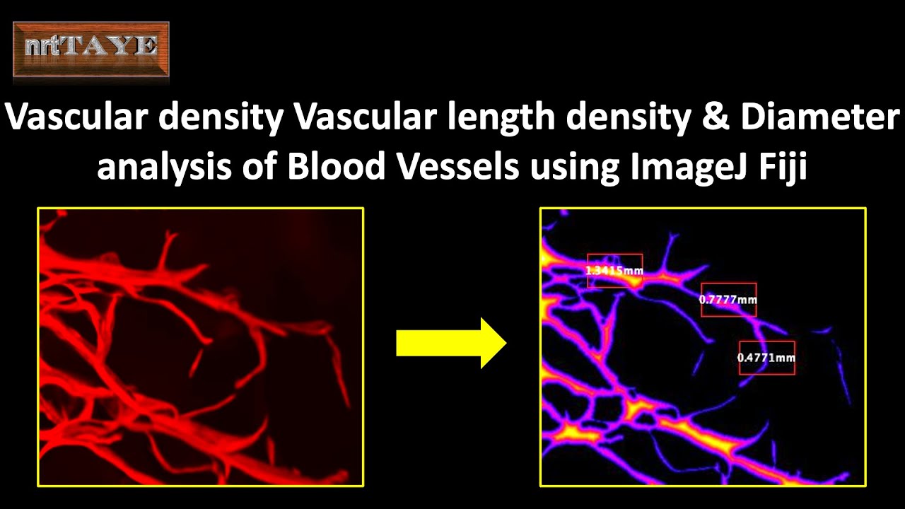 Vascular Density, Vascular Length Density and Diameter analysis of Blood Vessels using ImageJ Fiji