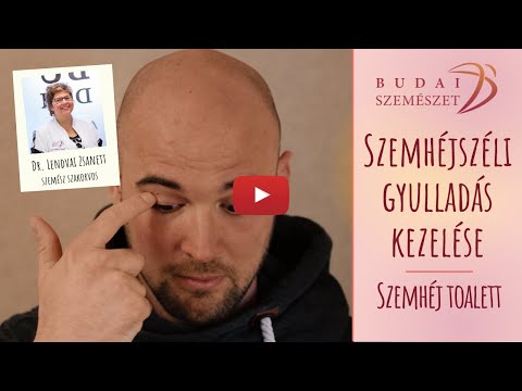 Paraziták a beleken kívül